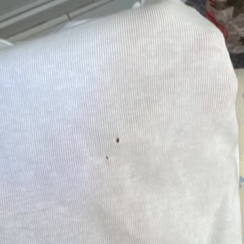 Arçelik Çamaşır Makinesinde Tekrarlayan Arızalar, Servis Reddi Ve Eksik Kayıtlar