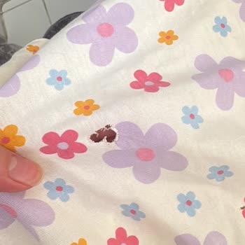 Arçelik Çamaşır Makinesinde Tekrarlayan Arızalar, Servis Reddi Ve Eksik Kayıtlar