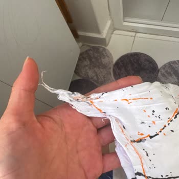 Arçelik Çamaşır Makinesinde Tekrarlayan Arızalar, Servis Reddi Ve Eksik Kayıtlar