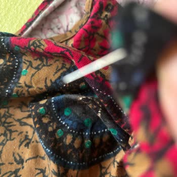 Defolu Elbise, İade Reddi Ve 322 TL Kesintisi