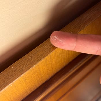 Etstur'un Tanıttığı Anadolu Hotels'te Oda Görüntüsü Ve Hijyen Çelişkisi