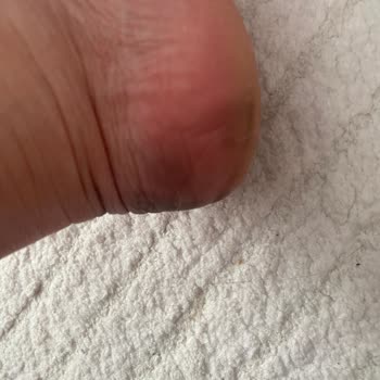 Ayakkabının Boya Sızması Ve Otomatik Onay Nedeniyle İade Reddi