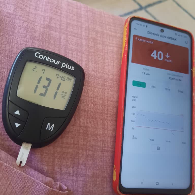 Sibionics GS1 Sensöründe Ölçüm Hatası Ve Sağlık Riski