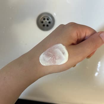 Celenes SPF 50 Güneş Kremi Yanma Ve Peeling Oluştu İade Talebi