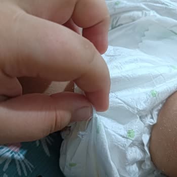 Sleepy 5 Numaralı Bebek Bezinde Tiftiklenme Ve Jel Dağılma Sorunu
