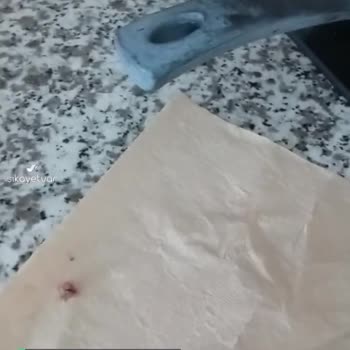 Gimsa Kıymadan Sinek Çıktı, Hijyen Sıfır