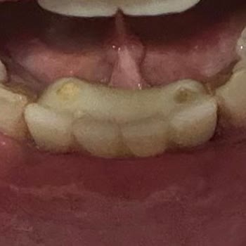 VDS Dental 100.000 TL’lik Peşin Ödemenin Tamamen İadesini Talep Ediyorum