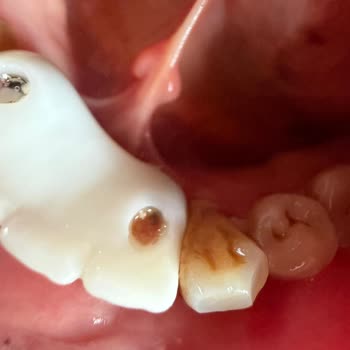 VDS Dental 100.000 TL’lik Peşin Ödemenin Tamamen İadesini Talep Ediyorum