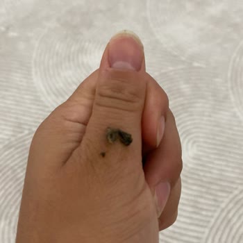 Sütaş Sütünde Küf Görülmesi Güven Kaybı