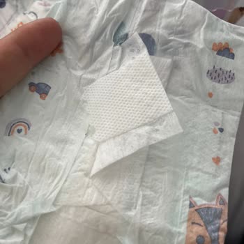 Pofy 2 Numaralı Bebek Bezlerinde Yapışkan Bant Arızası Ve Mağduriyet