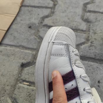 Adidas Superstar Ayakkabısında 10 Gün İçinde Açılma Ve Uzun Garanti Süreci