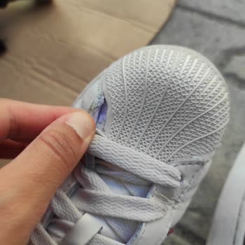 Adidas Superstar Ayakkabısında 10 Gün İçinde Açılma Ve Uzun Garanti Süreci