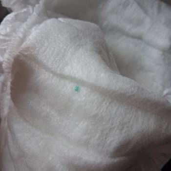 Sleepy Bebek Bezinde Plastik Parça Tespiti Ve Güvenlik Uyarısı