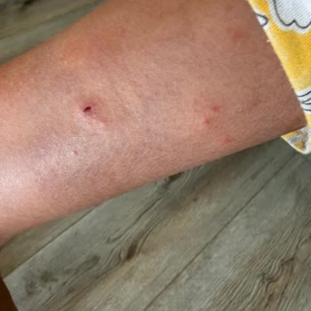 Salihleraltı Mahallesinde Araçlı Sivrisinek İlaçlaması Eksikliği