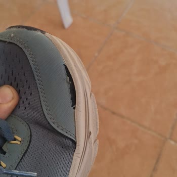 Skechers Ayakkabısının Kısa Sürede Açılması Ve Üretim Hatası Olmadığı İddiası