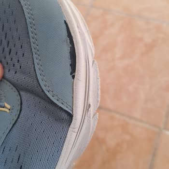 Skechers Ayakkabısının Kısa Sürede Açılması Ve Üretim Hatası Olmadığı İddiası
