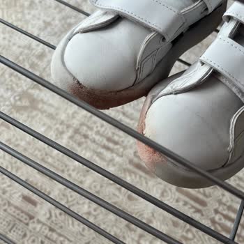 Üç Ay Kullanımda Adidas Çocuk Ayakkabısının Erimesi Ve İade Reddi