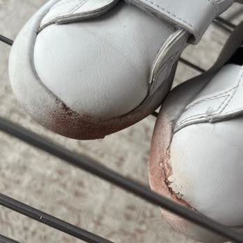 Üç Ay Kullanımda Adidas Çocuk Ayakkabısının Erimesi Ve İade Reddi