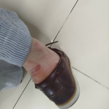 Sert Ve Küçük Deri Ayakkabı Yara Yaptı, Değişim Talebim Reddedildi
