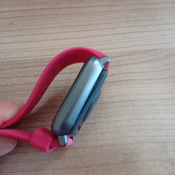 Pil Şişmesi Nedeniyle Saat Kullanılamaz, Mağaza Çözüm Sunmadı