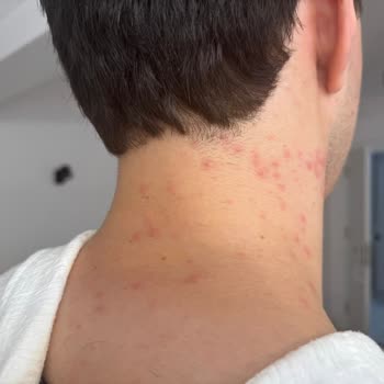 Hediye Yüz Jelinde Şiddetli Alerjik Reaksiyon Ve Müşteri Hizmetlerinde Saygısızlık