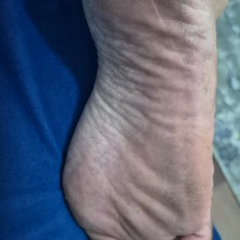 Ayağını Boyayan Terlikler İade Talebi Ve Müşteri Hizmetleri Sorunu