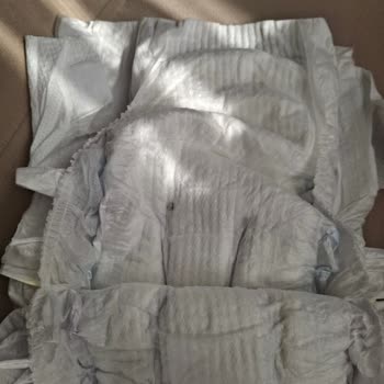 Molfix Bebek Bezinde Yabancı Cisim Bulunması Ve Değişim Talebi