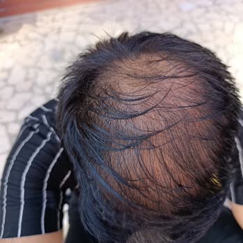 OMG Clinic Ödediğim Ücretin İadesini Talep Ediyorum