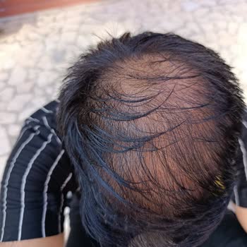 OMG Clinic Ödediğim Ücretin İadesini Talep Ediyorum