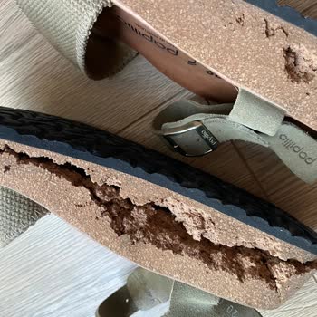 Az Kullanımda Bile Topuğu Patlayan Birkenstock Sandaleti