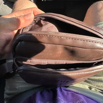 Fermuar Kırıldı, Mağaza Kullanıcı Hatası Dedi Ve Değişimi Reddetti