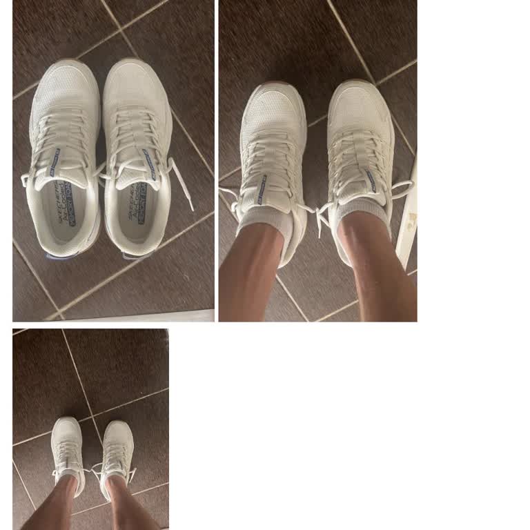 Skechers Ayakkabısının Kalıp Hatası Nedeniyle İade Ve Ücret İadesi Talebi