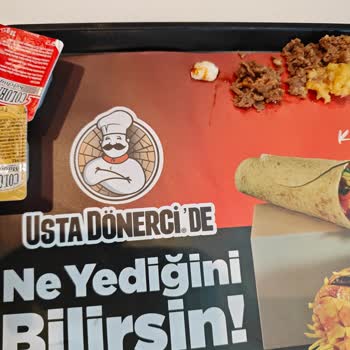 Usta Dönerci'de Çocuğa Gelen Keskin Kemik Ve Ücret İadesi Reddi