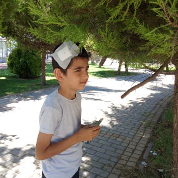 Fıstıklı Parkı’nda Çocuğum Kafasından Yaralandı, Güvenlik Ve Tazminat Talep Ediyorum