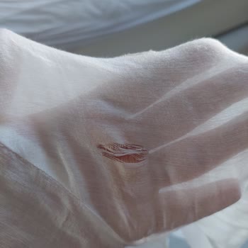 Qarmacha Üründeki Problemi Kullanım Hatası Olarak Değerlendirip Benimle İlgilenmediler