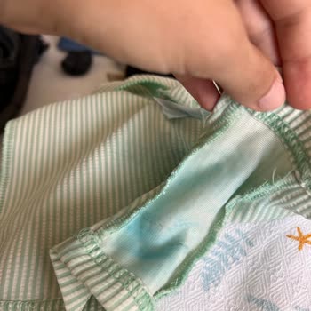 Mavi Boya Sızan Bebek Bezi Çocuk Kıyafetlerine Ve Cilde Zarar Verdi