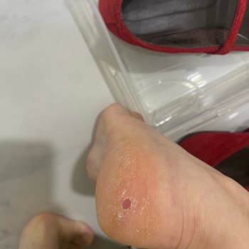 Kırmızı Babet İlk Giyimde Ayakları Yaraladı, İade Talebine Yanıt Gelmedi