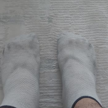 Terlik Giyildiğinde Çorap Ve Ayak Siyaha Boyanıyor Sağlık Riski Ve İade Talebi