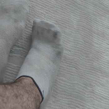 Terlik Giyildiğinde Çorap Ve Ayak Siyaha Boyanıyor Sağlık Riski Ve İade Talebi