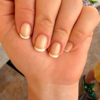 Flormar Let’s Care Ürünü Tırnaklarda Aniden Sararma Ve Sağlık Riskleri