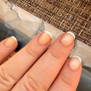 Flormar Let’s Care Ürünü Tırnaklarda Aniden Sararma Ve Sağlık Riskleri