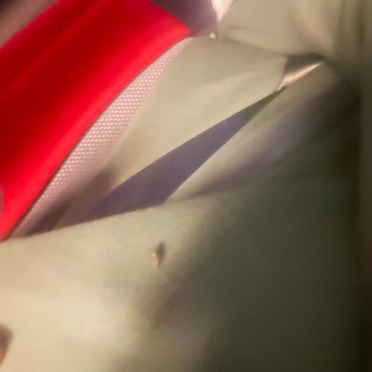 Varan Turizm Otobüsünde Pire Isırıkları Ve Hijyen Eksikliği