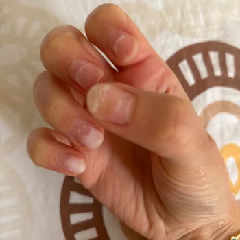 Kalıcı Oje Sonrası Tırnaklarda Kırılma Ve Deformasyon, İşletmenin İlgisizliği