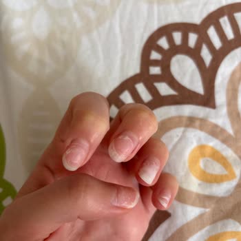 Kalıcı Oje Sonrası Tırnaklarda Kırılma Ve Deformasyon, İşletmenin İlgisizliği