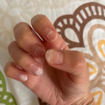 Kalıcı Oje Sonrası Tırnaklarda Kırılma Ve Deformasyon, İşletmenin İlgisizliği