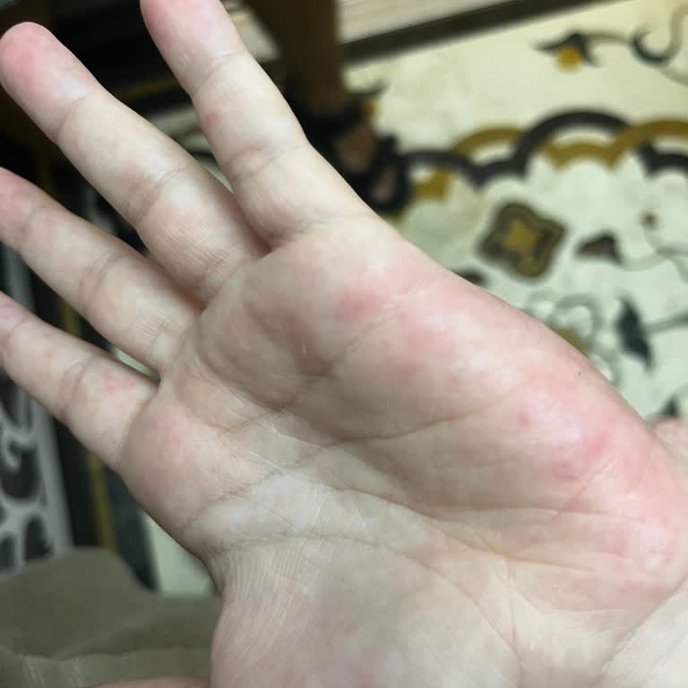 Havuz Hijyeninde Eksiklik, Çocukta Alerjik Reaksiyon Ve Ücretsiz Doktor Talebi
