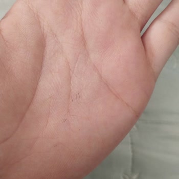 Pia Markasının Kirpik Kıvırma Aletinde Metal Teması Kirpik Kaybına Neden Oldu