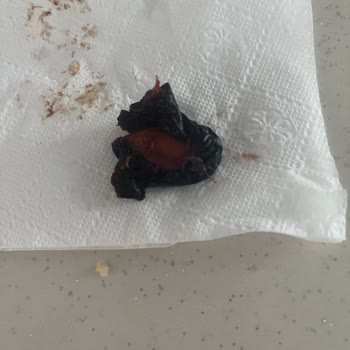 Çekirdeksiz Kuru Erik Üründe Çekirdek Çıkan Diş Kırılmasına Yol Açtı