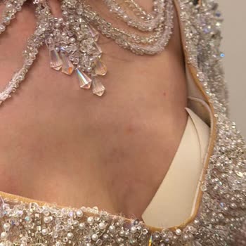 Gökhan Gökay Dress Moda Parayı Alana Kadar Son Derece İlgili Görünen İşletme