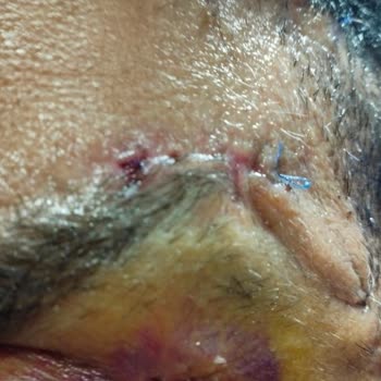 Prof. Dr. Ali Gürlek Estetik Söz Verdiği Yüz Ve Göz Estetik Operasyonlarını Yapmaması